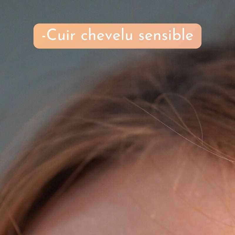 Cuir chevelu Sensible